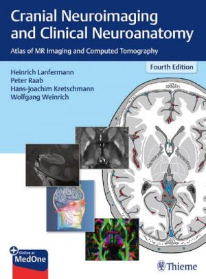 Thieme cranial neuroimaging