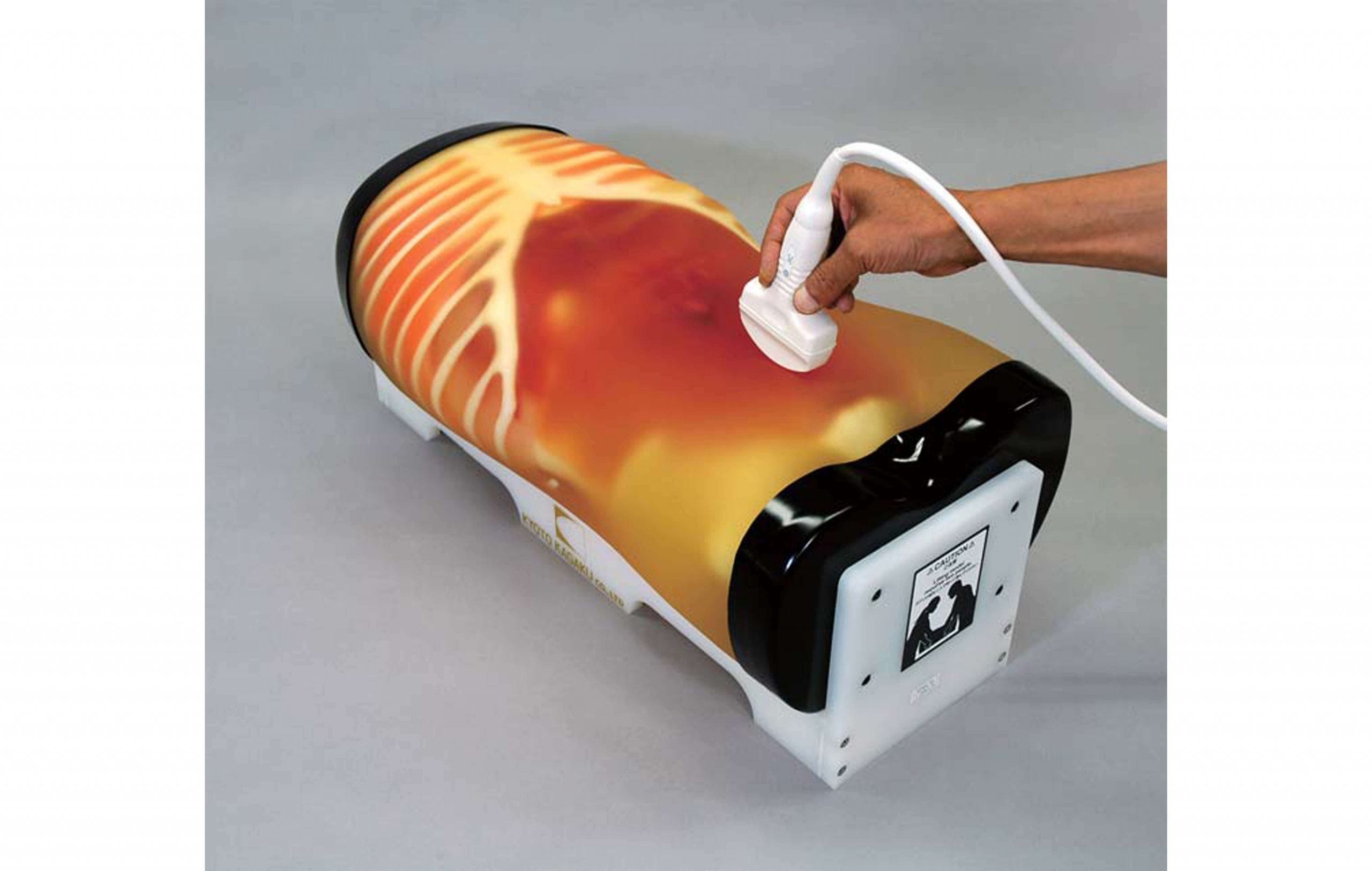 MediScientific FAST acute abdomen