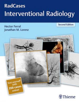 Thieme interventional radiology