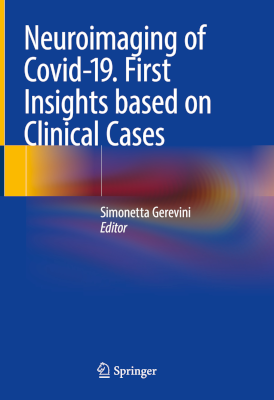 Neuroimaging of Covid-19 cover