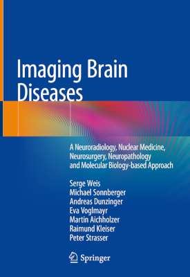 Imaging Brain Diseases cover