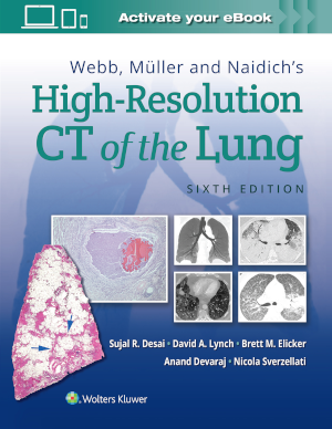 High-Resolution CT of the Lung cover