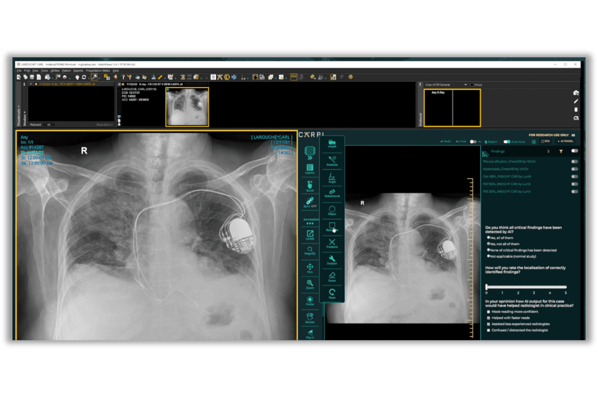 CARPL.ai and Philips integration
