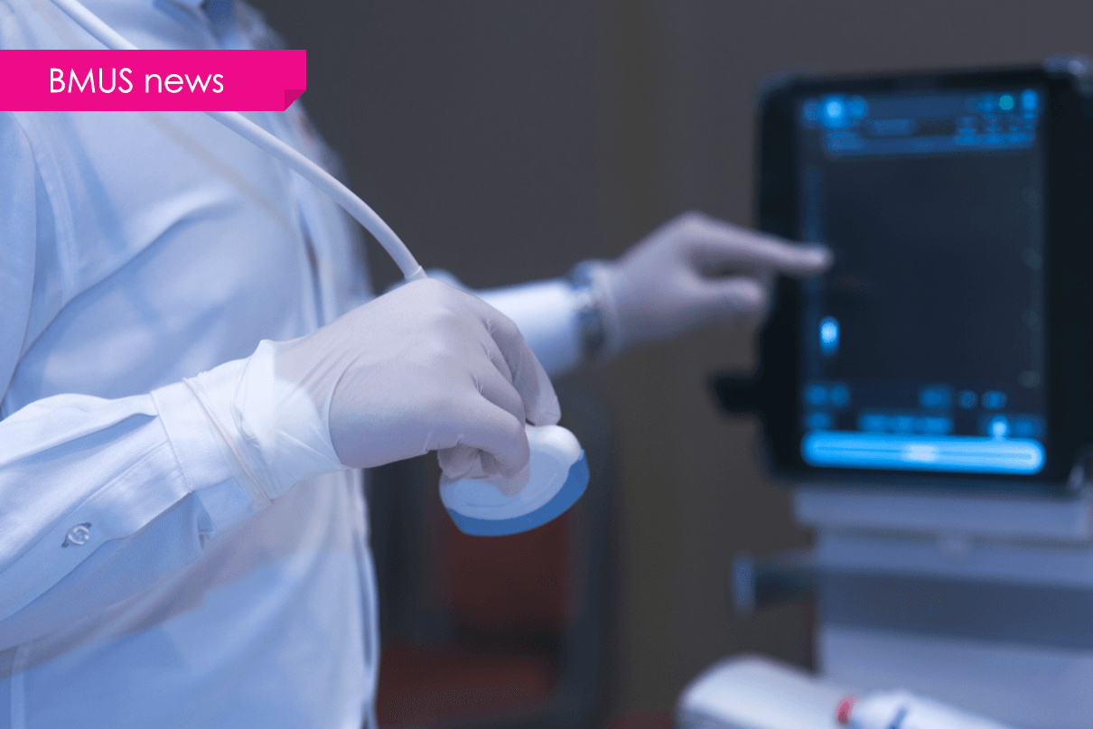 Nanosonics probe disinfection