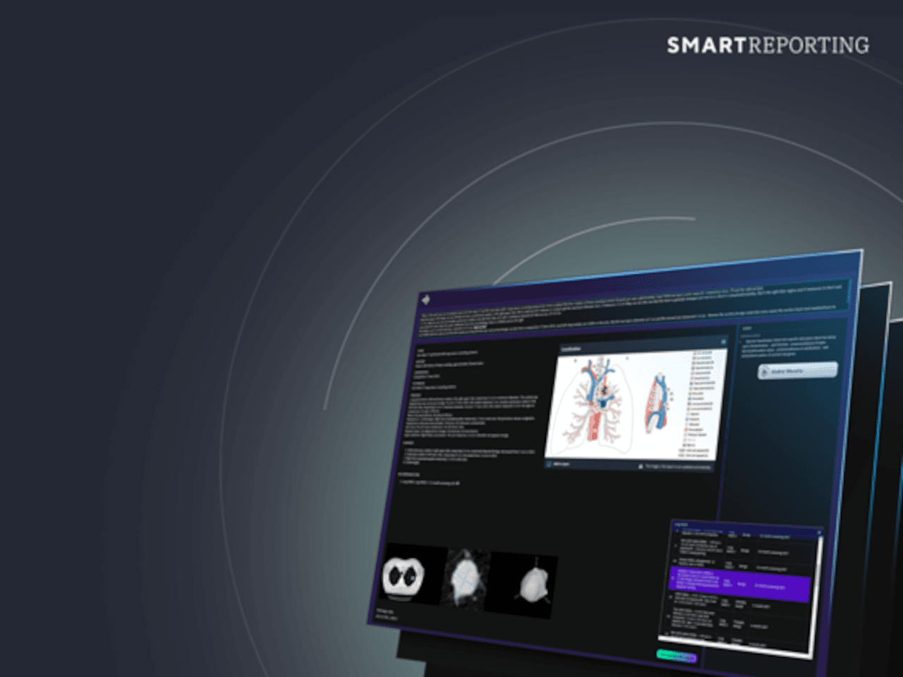 Smart Reporting Software