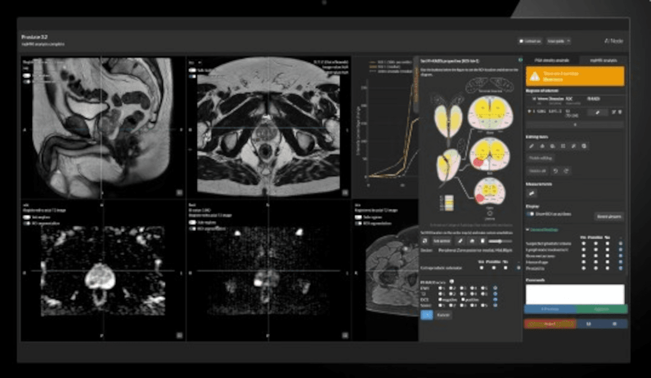 DeepHealth Prostate AI