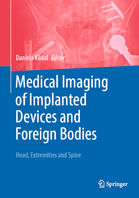 Medical Imaging of Implanted Devices