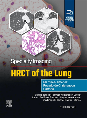 HRCT of the Lung