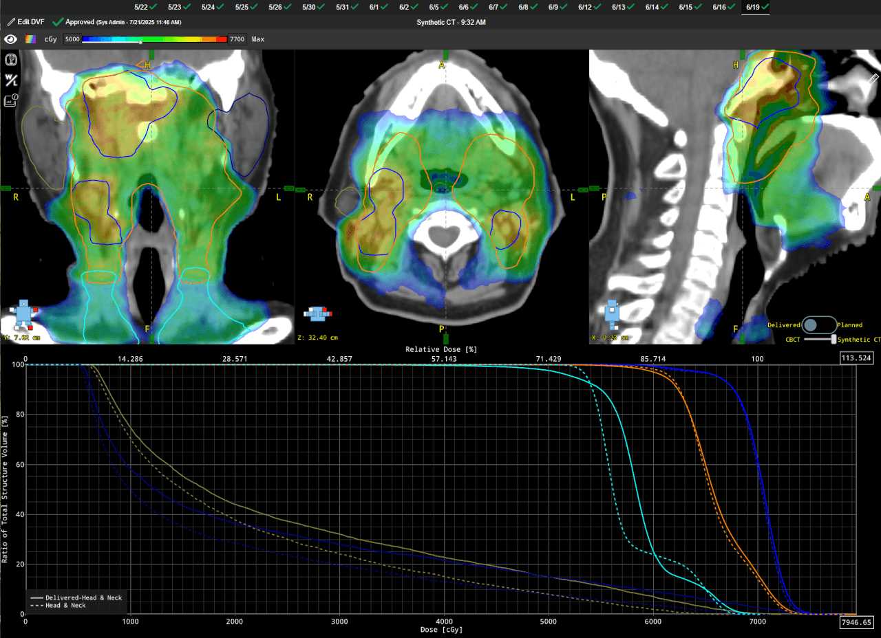 OIS and Radformation software
