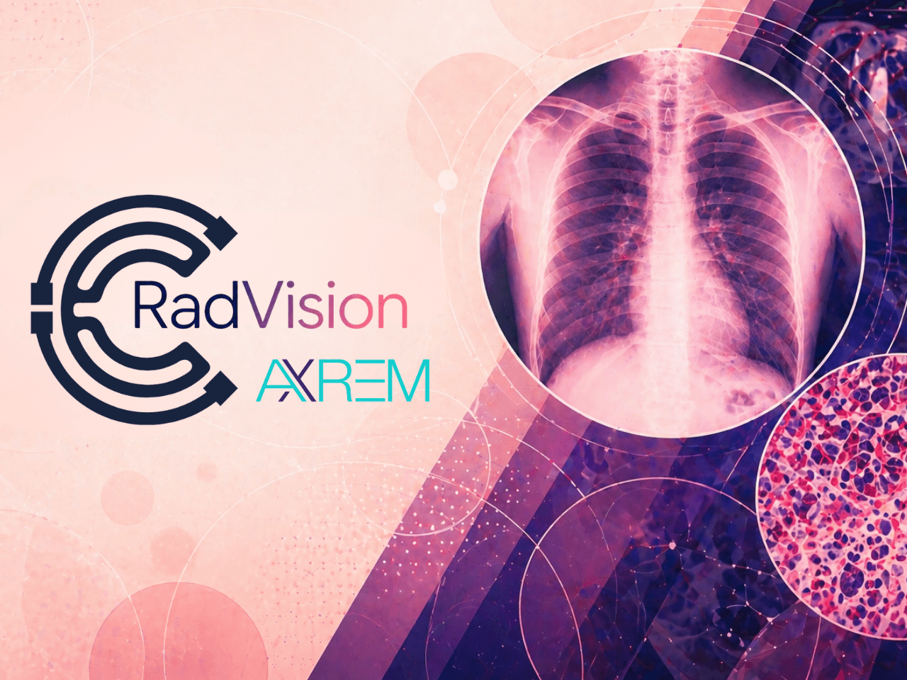 RadVision