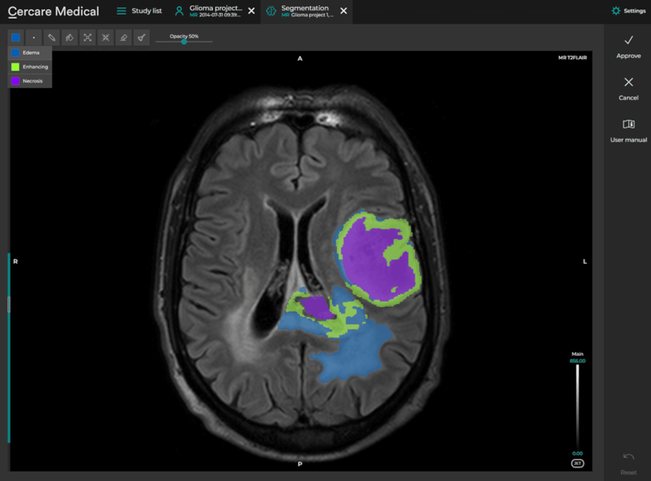Cercare Neurosuite v18
