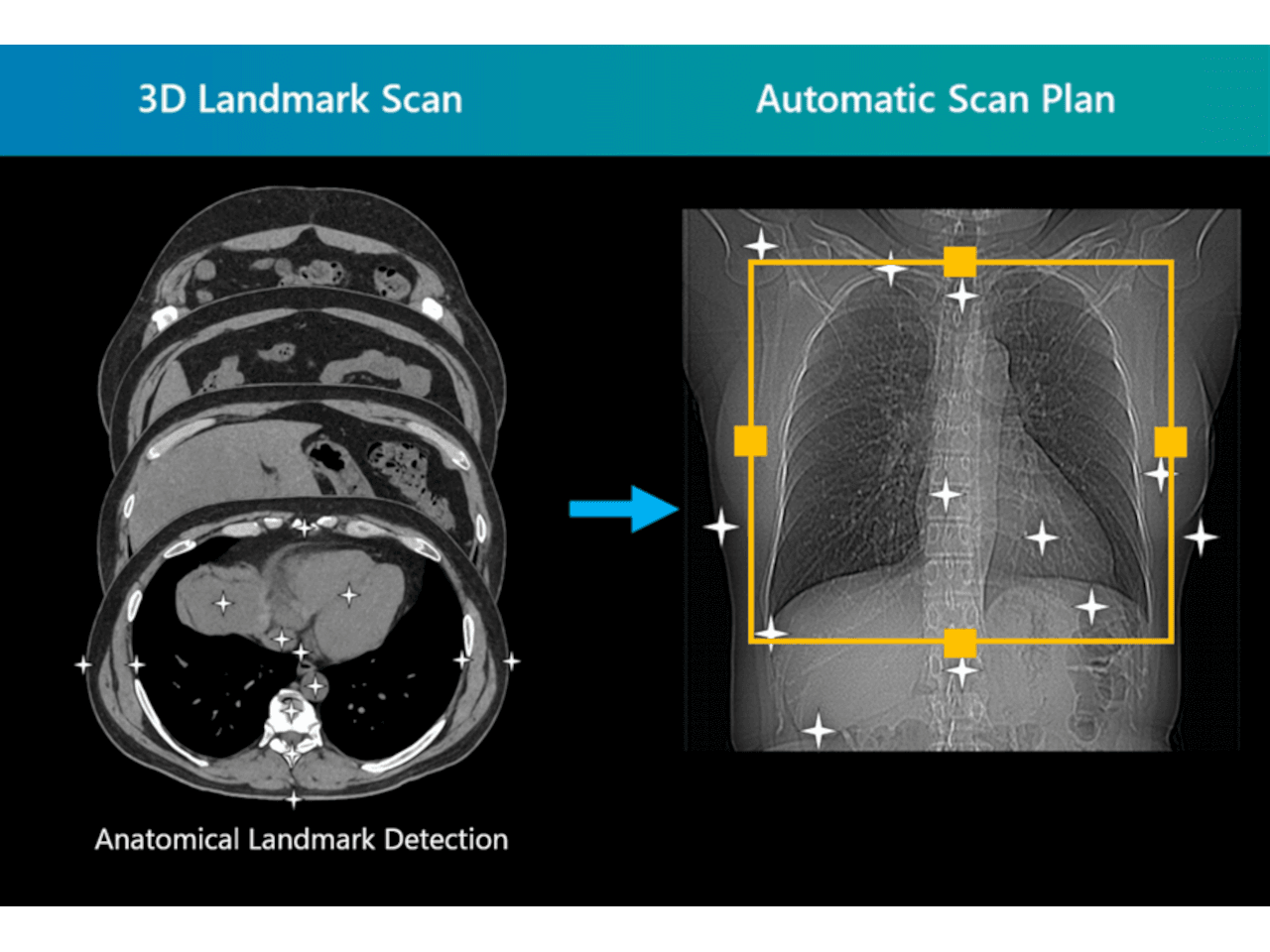 3D Landmark Scan