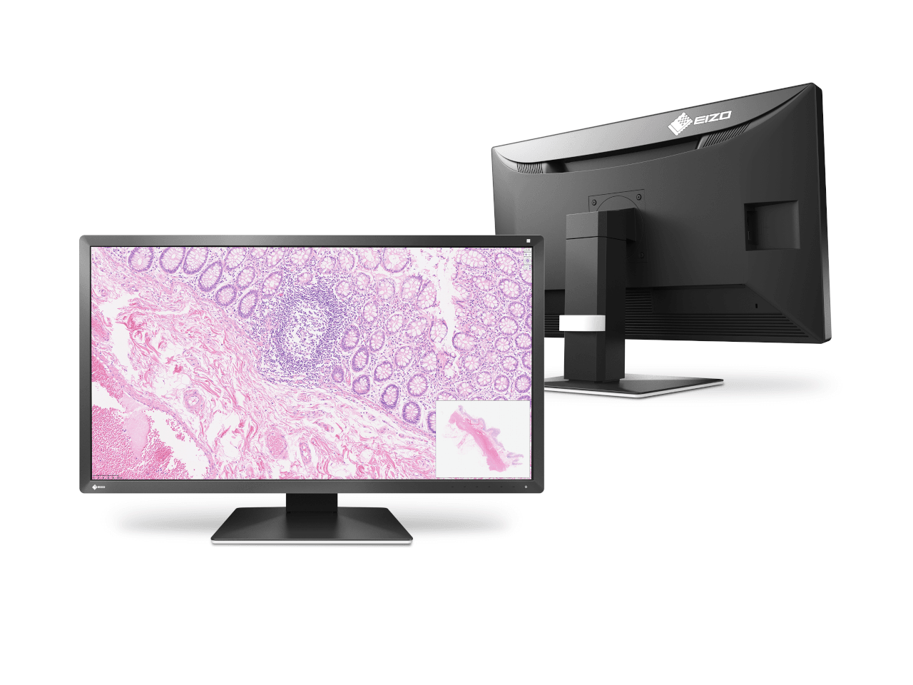 PX3150 monitor