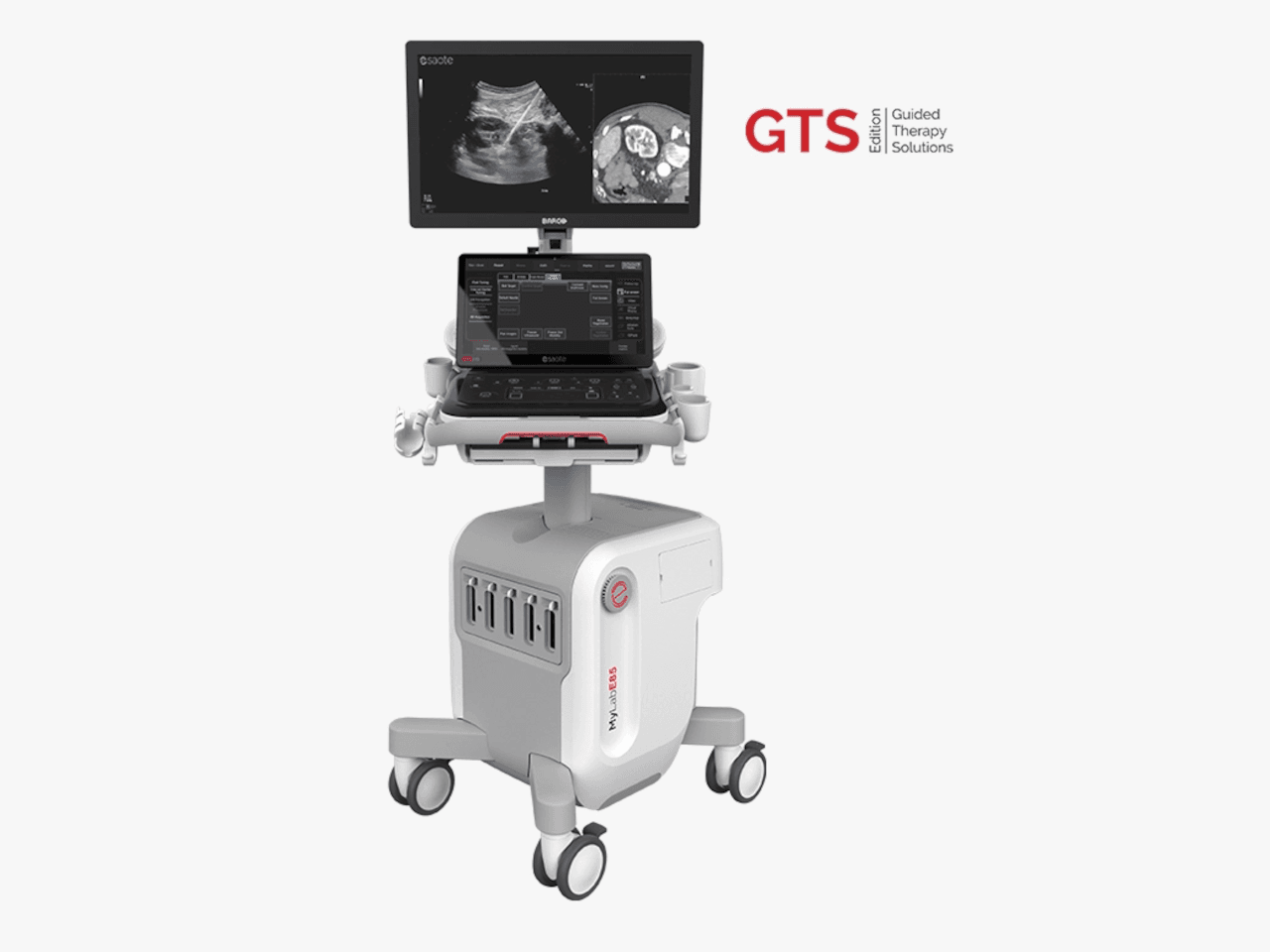 Esaote MyLab E85 GTS