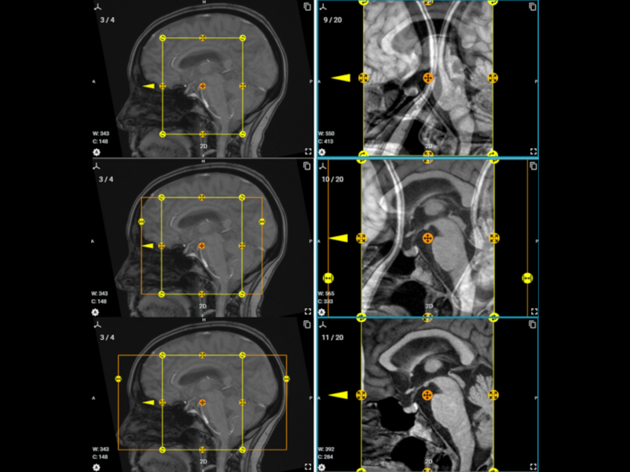 Sagittal pituitary imaging