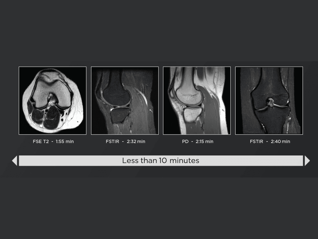 Knee MRI