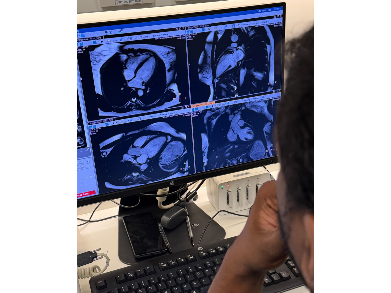 Cardiac MRI imaging