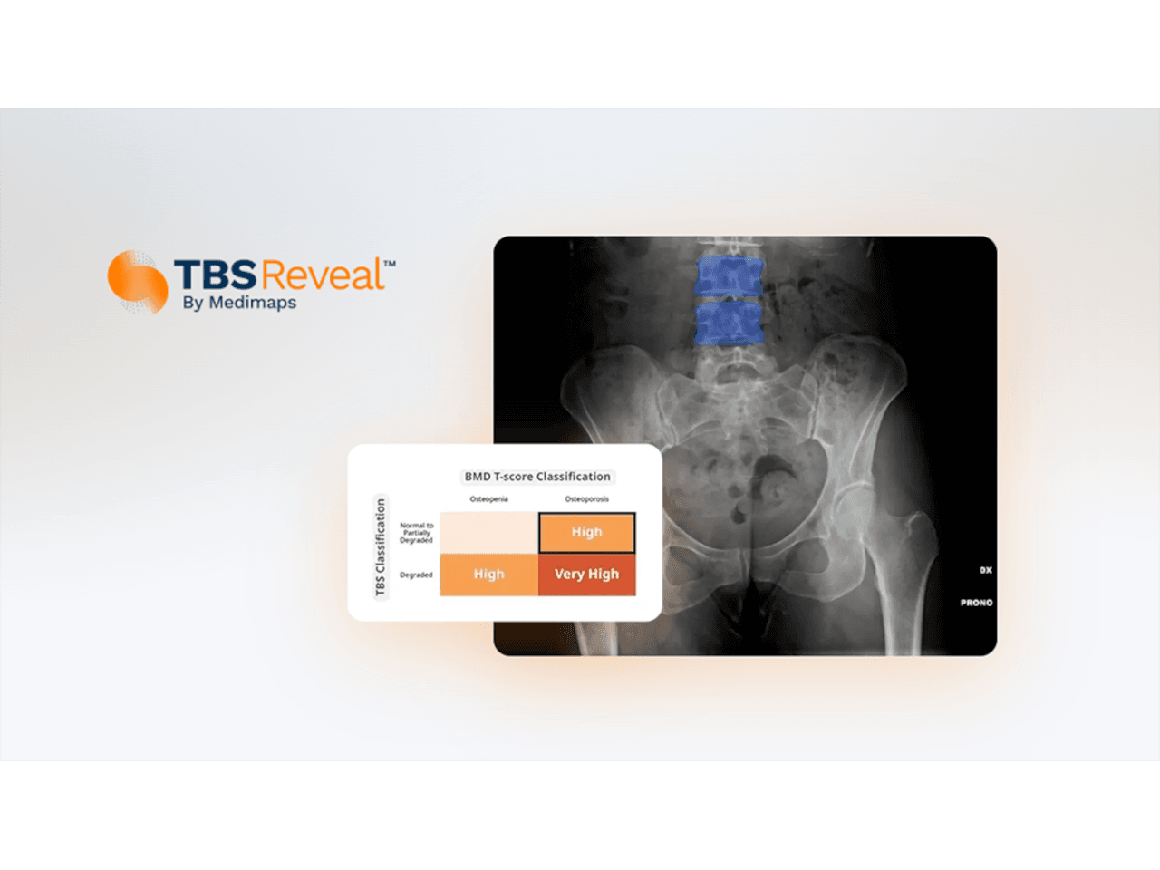 Medimaps TBS